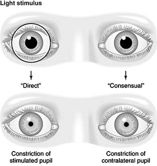 Figure 14-31