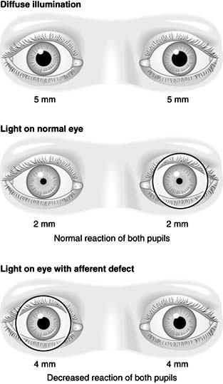 Figure 14-32
